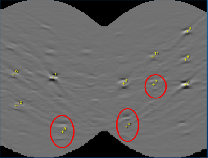 Al合金TKD花样按照标准的菊池带探测模式得到的Hough空间分布图