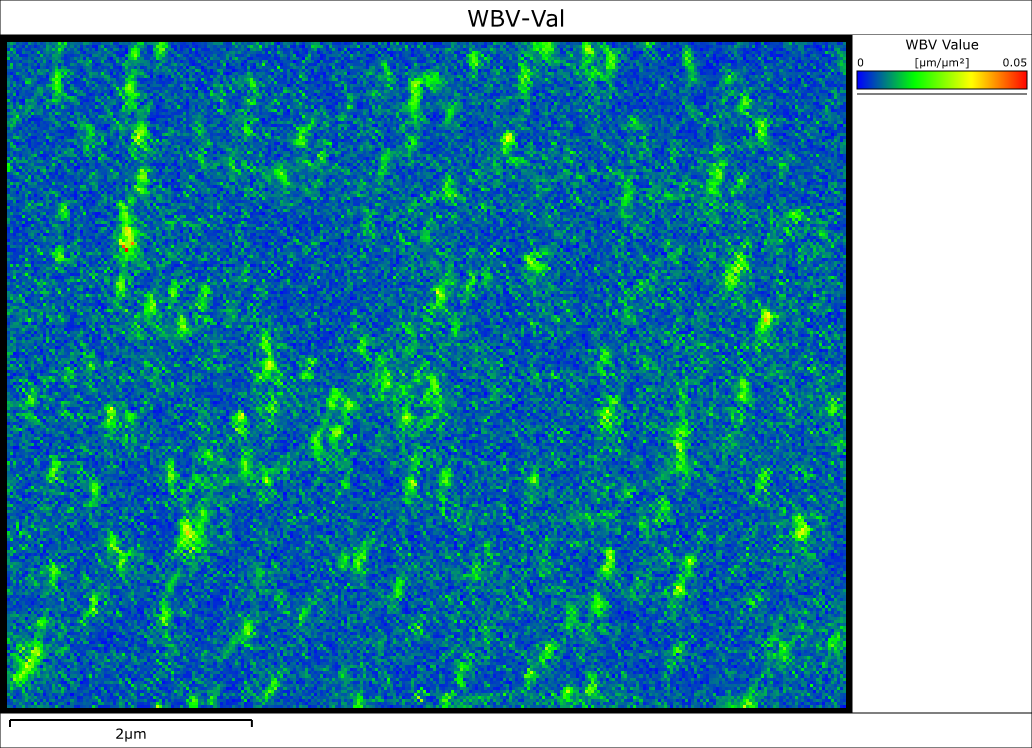 Weighted Burgers Vector magnitude EBSD map of a GaN thin film showing clear resolution of individual dislocations Weighted Burgers Vector magnitude EBSD map of a GaN thin film showing clear resolution of individual dislocations